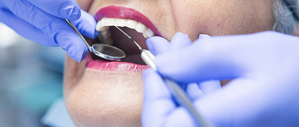 Best Emergency Dentist for Lost Fillings or Crowns in Delray Beach, FL
